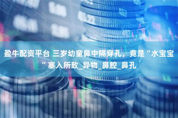 盈牛配资平台 三岁幼童鼻中隔穿孔，竟是“水宝宝”塞入所致_异物_鼻腔_鼻孔